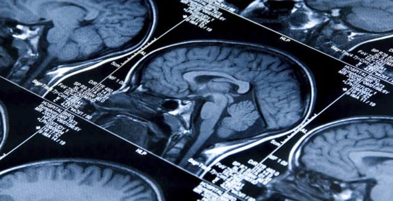 Rare brain disease caused by free-living amoebae in water reported in Kerala