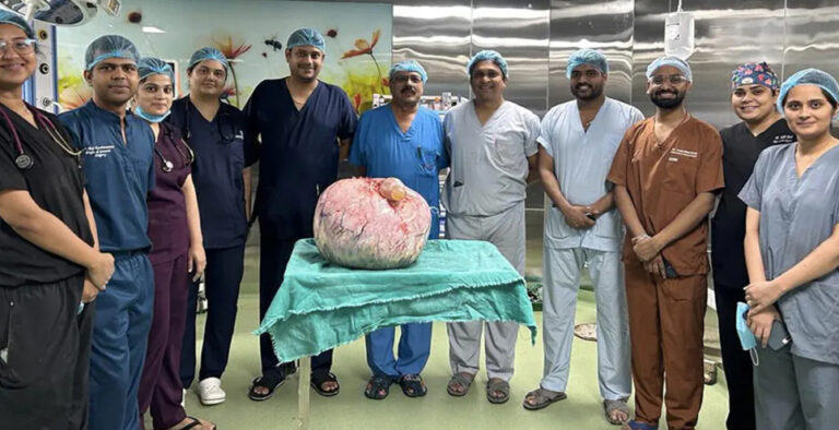 Doctors find 15Kg tumour in woman complained of stomach ache